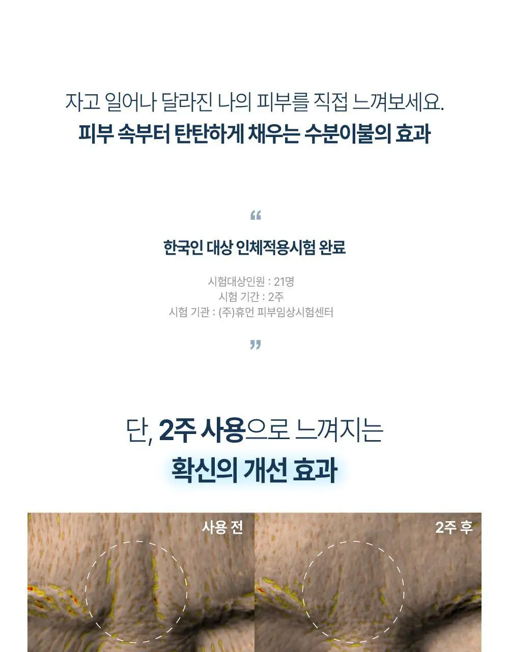 [OY단독] 라보타치 미간 케어 패치 18매 상세페이지 24